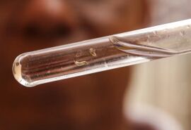 Dengue e Chikungunya matam 70 em Mato Grosso; 40 foram em Cuiabá e VG